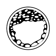 Embryo Transfer